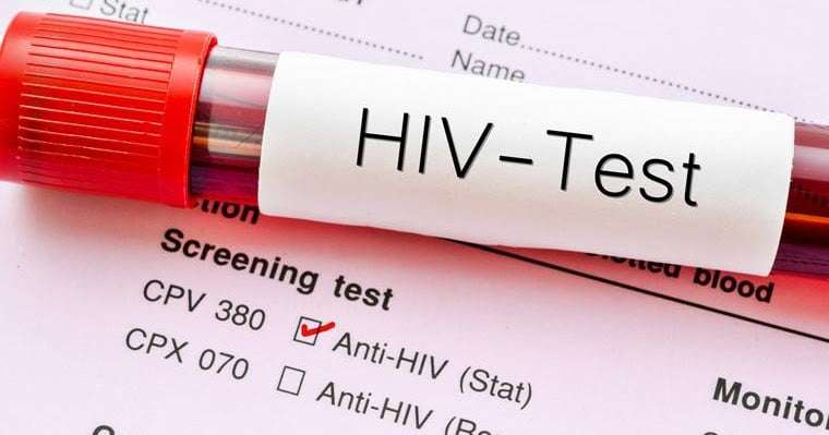 Αυξάνονται τα αδιάγνωστα κρούσματα HIV στην Ευρώπη | in.gr