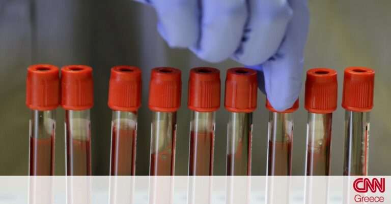 Tεστ αίματος θα δείχνει πόσο αποτελεσματικό είναι το εμβόλιο κατά της Covid – 19