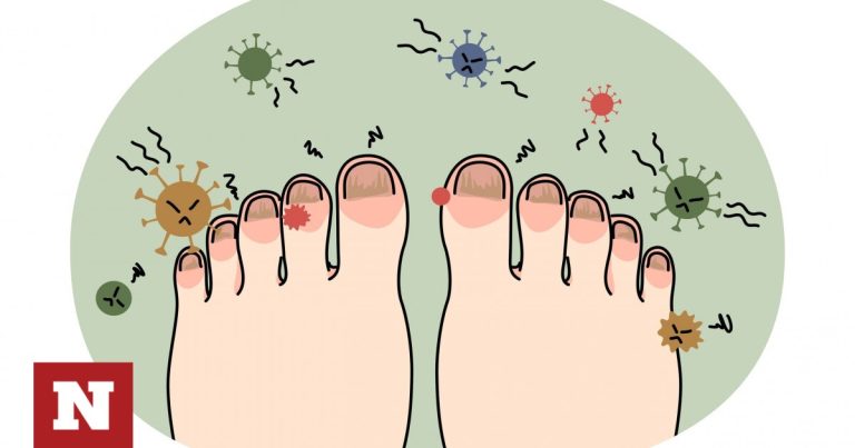 Νύχια ποδιών: Τι δείχνουν για την υγεία ανάλογα με το χρώμα τους