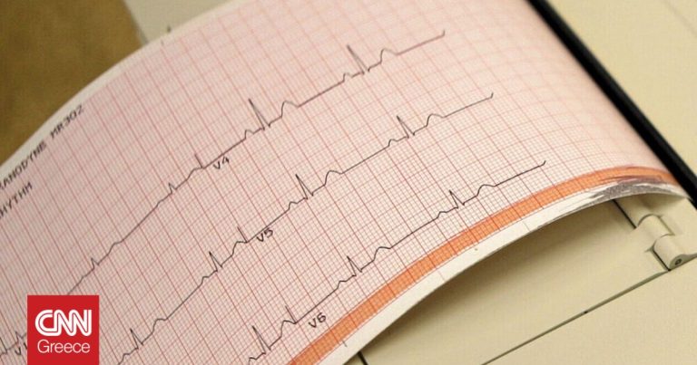 Κορωνοιός: Πέντε απαντήσεις για την προστασία της καρδιάς – Τι λέει ο καρδιολόγος Γεράσιμος Σιάσιος